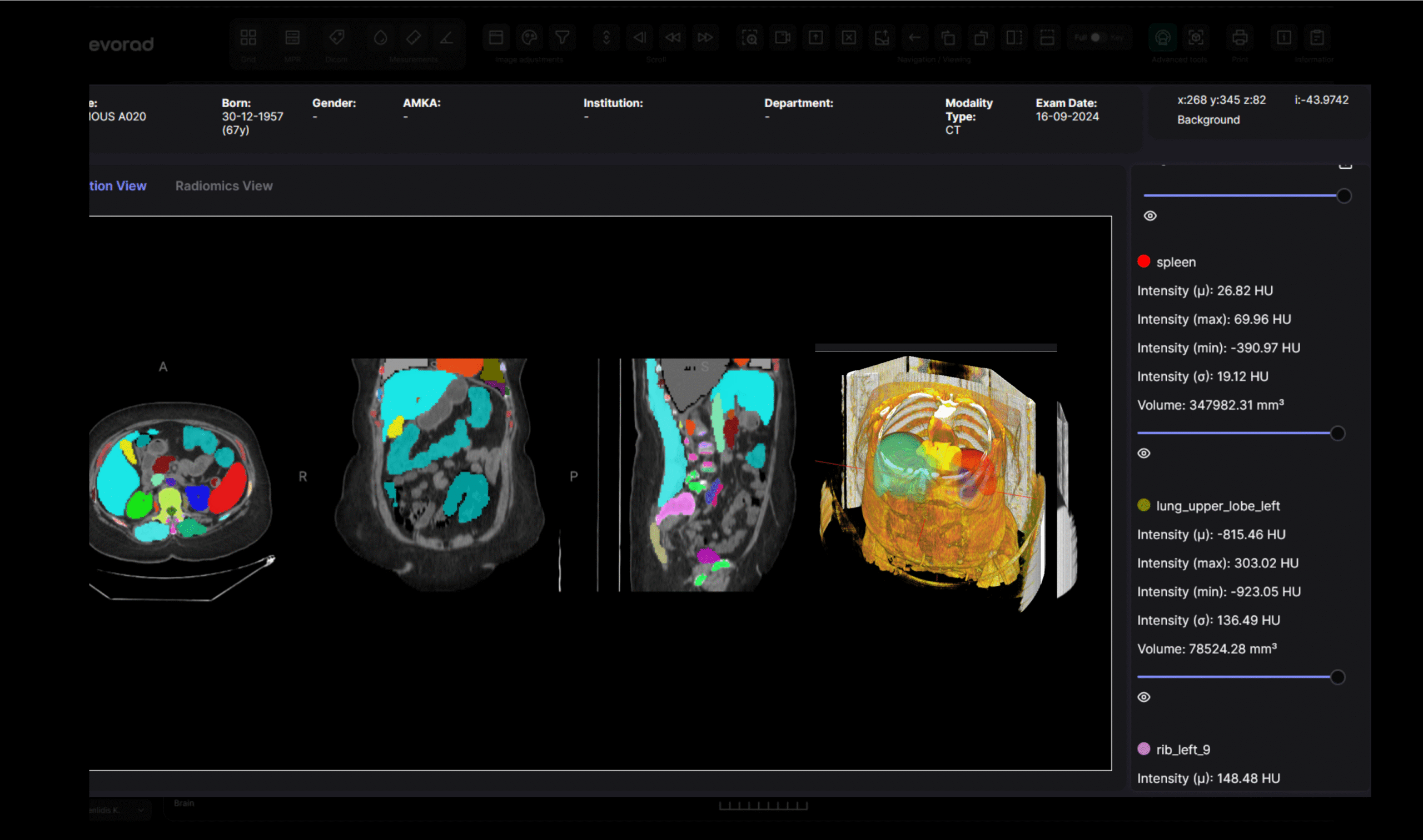 volumetrica viewer with 3D segmentation